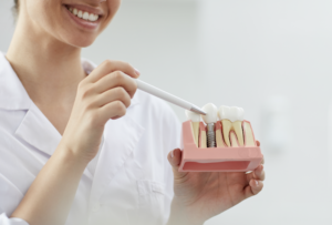 Pocessus d'implant dentaire expliqué par un dentiste